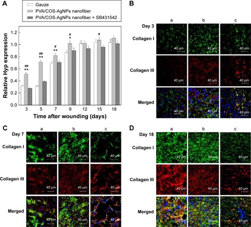 Figure 4 Determination of collagen content in the skin samples.Notes: (A) Hyp content increases in all groups over time, especially in the PVA/COS-AgNPs nanofiber group. (B–D) Immunofluorescent staining of collagen I (green) and collagen III (red) at 3, 7, and 18 days postgrafting with (a) gauze, (b) PVA/COS-AgNPs nanofiber, (c) PVA/COS-AgNPs nanofiber plus SB431542.Abbreviations: Hyp, hydroxyproline; PVA, poly(vinyl alcohol); COS, chitosan oligosaccharide; AgNPs, silver nanoparticles.