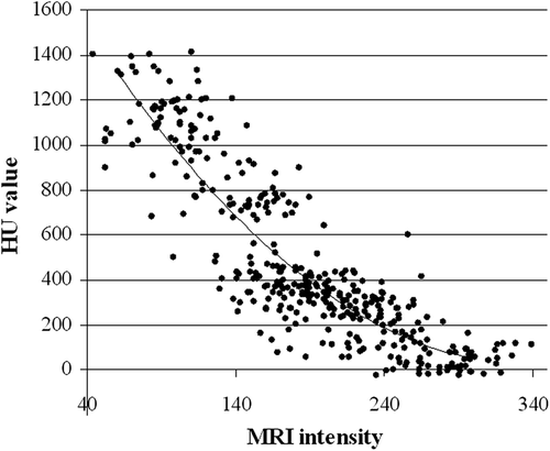 Figure 2. Relation between MRI intensity (in-phase image) and HU number obtained for 400 randomly chosen voxels within the pelvic bones. The second order polynomial fit is expressed as a solid line.