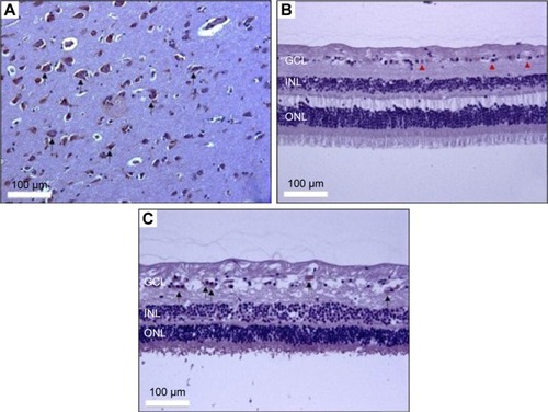 Figure 4 Immunohistochemical assay of LTA in human retina.