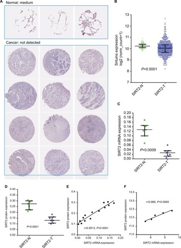 Figure 6 Concordance of SIRT2 mRNA and protein expressions in NSCLC. (A). SIRT2 immunohistochemical staining results in normal lung tissues (n=3) and lung cancer tissues (n=12). The images were obtained from the Human Protein Atlas.Citation43 (B). SIRT2 mRNA expression in normal lung tissues (n=110) and lung cancer tissues (n=1017) in the TCGA NSCLC cohort. (C–E). SIRT2 mRNA expression detected by qRT-PCR (C) and protein expression detected by Western blotting (D) in seven lung cancers and paired adjacent normal tissues (n=7); consistency of SIRT2 mRNA and protein expression were explored by Pearson’s correlation analysis (E). These were re-analyses results of Li et al’s report.Citation44 (F). Associations of SIRT2 mRNA with protein expressions in lung cancers. SIRT2 protein expression and mRNA expression data were extracted from proteomics and gene microarray profiles, respectively, which was reported by Stewart et al.Citation46Abbreviations: SIRT2, sirtuin 2; N, normal; T, tumor; qRT-PCR, quantitative real-time polymerase chain reaction.