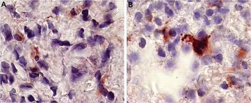 Figure 5 Pre- and postbiopsy examination of tissues at time zero and after 6 months of a patient on Ambovex® treatment therapy.