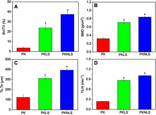 Figure 10 Quantitative analysis of BV/TV (A), BMD (B), Tb.Th (C), and Tb.N (D)of the samples (* p<0.05, vs PK).Abbreviations: BV/TV, bone volume/total volume; BMD, bone-mineral density; Tb.Th, trabecular thickness; Tb.N, trabecular number.