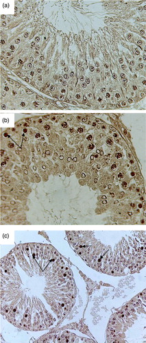 Figure 4.  Microphotograph of TUNEL staining after 2 weeks for control, pairfed, and zinc deficient groups. Note: 400X. (A) Microphotograph of testes of 2ZC group revealing negative TUNEL staining in all the germ cells. (B) Microphotograph of testes of 2PF group showing few TUNEL positive germ cells (arrows). (C) Microphotograph of testes of 2ZD group exhibiting few TUNEL positive apoptotic spermatogonia and primary spermatocytes (arrows).