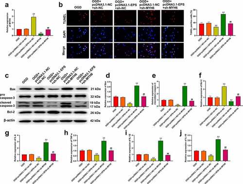 Figure 6. LincRNA-EPS represses OGD-induced inflammation and apoptosis by HNRNPL/MYH6 axis in HL-1 cells. (a-j) The OGD-treated HL-1 cells were treated with pcDNA3.1 or pcDNA3.1 lincRNA-EPS overexpression vectors, or co-treated with pcDNA3.1 lincRNA-EPS overexpression vectors and HNRNPL shRNA or MYH6 shRNA. (a) The expressions of MYH6 were tested using qRT-PCR. (b) The apoptosis of HL-1 cells was analyzed with TUNEL staining. (c-f) The expressions of Bax, Bcl-2, caspase-3 and cleaved caspase-3 were evaluated with Western blot. (g-j) The mRNA expression of IL-6, TNF-α, IL-1β, and IL-18 was tested using qRT-PCR. Data are presented as mean ± SD. Statistic significant differences were indicated: ** P < 0.01, ## P < 0.01.