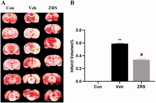 Figure 2. Effects of ZRS on the infarct volume in MCAO rats. (A) The effect of ZRS on the infarct size was measured by performing TTC staining. After TTC staining of the brain, the lesions appeared as white areas. Samples from the ZRS treatment group had smaller lesions than those from the vehicle group. No obvious lesions were observed in the control group. (B) Quantitative analysis of the infarct volume in rat brain tissue. Control vs. vehicle, **p < 0.01; ZRS vs. vehicle, #p < 0.05, n = 6 rats per group, means ± SEM.