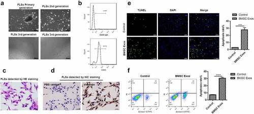 Figure 2. BMSCs exosomes promoted the apoptosis of FLSs. (a) Optical microscope phenotype of primary FLSs routinely cultured to the third passage identified by the inverted microscope. Bar = 200 μm. (b) Flow cytometry was used to detect the CD55 positive cells. (c) H&E staining analysis for synoviocyte nucleus located in the center of cells, with reddish cytoplasm. (d) Immunohistochemical staining to detect the FLSs, the positive cells were stained brown, which was indicated by Vimentin, and the control group using PBS showed no staining in the cytoplasm. (e) TUNEL to detect the percentage of FLSs occurring apoptosis under treatment with BMSCs exosomes. (f) Flow cytometry analysis was used to detect the apoptosis rate of FLSs under treatment with BMSCs exosomes. The data were expressed as mean ± SEM, ***p < 0.001, ****p < 0.0001, Exos group vs control group.