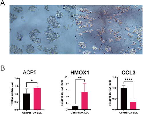Figure 8 In Vitro Analyses. (A) Representative images of Oil red O staining of Raw264.7 cells with/without Ox-LDL (100 µg/mL) for 48 hours. (B) Verified the expression of hub genes. Relative mRNA level of ACP5, HMOX1 and CCL3 in RAW264.7. *p < 0.05, **p < 0.01, ****p < 0.0001.