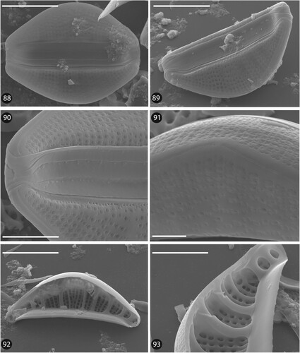 Figs 88–93. SEM micrographs of Epithemia boucheziae sp. nov. from type material TCC1089. Figs 88–91. External valve view. Figs 92–93. Internal valve view. Scale bars = 10 µm (88, 89, 92). Scale bars = 5 µm (90, 93). Scale bars = 2 µm (91).