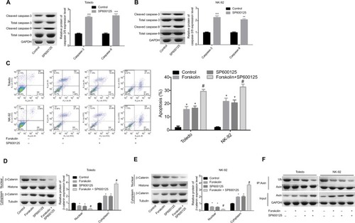 Figure 6 SP600125 enhanced cell apoptosis induced by forskolin in NHL cells.Notes: (A, B) The expression of the total or cleaved caspase-3/9 was decided by Western blotting after Toledo or NK-92 cells were treated with SP600125 (20 μM) or not (n=3, **P<0.01, ***P<0.001, SP600125 group vs control group). (C) Flow cytometry was used to determine cell apoptosis rates after Toledo or NK-92 cells were treated with SP600125 (20 μM) or not (n=3, *P<0.05, SP600125 group or forskolin group vs control group; #P<0.05, forskolin + SP600125 group vs forskolin group). (D, E) Toledo and NK-92 cells were treated with forskolin (40 μM), SP600125 (20 μM), forskolin (40 μM) + SP600125 (20 μM), or nothing, then cells were collected and the protein expression of cytoplasmic and nuclear β-catenin was examined by Western blotting (n=3, *P<0.05, SP600125 group or forskolin group vs control group; #P<0.05, forskolin + SP600125 group vs forskolin group). (F) Toledo and NK-92 cells were treated with forskolin (40 μM), SP600125 (20 μM), forskolin (40 μM) + SP600125 (20 μM) or nothing, then IP assay was conducted to measure the ubiquitination of Axin protein.Abbreviation: GAPDH, glyceraldehyde 3-phosphate dehydrogenase.