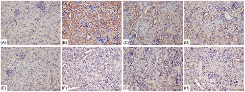 Figure 8. Deposition of Kim-1 on renal tubules. Kim-1 detected by IHC/DAB kit. (A) Blank control, (B) 72 h TCE+, (C) 72 h B1RA+, (D) 72 h B2RA+, (E) vehicle control, (F) 72 hr TCE−, (G) 72 h B1RA−, and (H) 72 h B2RA− group. Magnification =200×. Representative photos are shown.