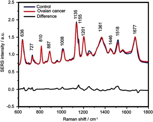 Figure S5 The mean surface-enhanced Raman scattering (SERS) spectra of serum from controls and ovarian cancer patients and their difference. The SERS spectra were acquired by focusing a 532 nm laser (10 mW) on the samples for 40 s. The SERS spectra were mean normalized and for each spectrum, two measurements were averaged