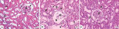 Figure 1. Photomicrographs of the renal cortex sections stained by hematoxylin and eosin: (A) Control group showing renal corpuscle with glomerulus (G), the parietal layer of Bowman’s capsule consists of a layer of flat cells (arrow), Bowman’s space(S). The proximal convoluted tubules (P) with cuboidal cells lining, narrow lumen and deeply stained cytoplasm. Distal convoluted tubules (D) with a wider lumen, cuboidal cells, rounded central nuclei and the cytoplasm is pale. (B) Gentamicin treated group showing shrunken glomerulus (G) and dilated renal space(S). Cells of both proximal (P) and distal (D) convoluted tubules showing vacuolated cytoplasm (v), most of them with pyknotic nuclei (arrowhead). Desquamated cells can be observed in the tubular lumen (arrows). Note the presence of empty spaces(e)and mononuclear cellular infilteration (I). (C) Gentamicin and AGE cotreated group showing apparently normal renal cortex,glomerulus(G), some cells show vacuolations of cytoplasm (v) most of the cells have vesicular nuclei (arrows). (Hx & E x400)