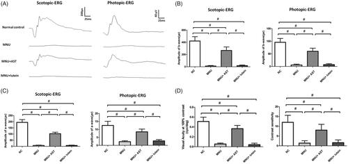 Figure 2. (A) Representative ERG waveforms of animal groups. AST nanodispersions produced with Polysorbate 20 were used for the following therapeutic trial. The visual function of MNU group was severely devastated. There was also a prominent reduction in the ERG responsiveness of the MNU + lutein group. By contrast, the ERG responsiveness in the MNU + AST group was less deteriorated. (B, C) The a- and b-wave amplitudes were significantly smaller in the MNU + lutein group than those in the normal controls. The a- and b-wave amplitudes were significantly greater in the MNU + AST group than those in the MNU + lutein group. (D) The visual acuity and contrast sensitivity in the MNU group were significantly smaller compared with the normal controls. The mice in the MNU + lutein group showed no significant improvement in optokinetic tests. Conversely, the visual acuity and contrast sensitivity were significantly larger in the MNU + AST group than those in the MNU group (ANOVA analysis followed by Bonferroni’s post hoc analysis was performed, #p < .01, for differences between groups; n = 10).