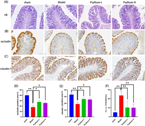 Figure 5. PSH improves intestinal barrier integrity in 5/6Nx rats. (A) H&E staining of colon tissue (×100); (B–E) immunohistochemical analysis of tight junction proteins of the intestinal mucosal barrier (occludin and claudin-1) in colon tissue; (F) serum level of diamine oxidase. Data are presented as mean ± standard deviation (*p<.05, **p<.01).