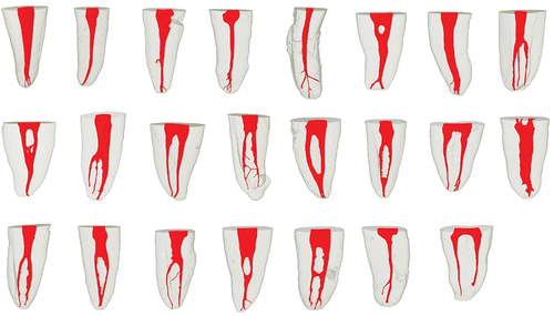 Figure 1. Root canal configurations by micro ct observed in mandibular premolars.