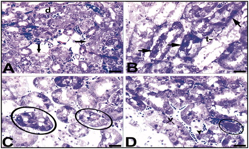Figure 5. Light microscopy of renal tissue samples which are obtained from the Hg group. d, distal tubule; arrow (A), tubule cells with hydropic degeneration; arrow (B), cells with the damaged-looking which are stained darkly cytoplasm and pycnotic nuclei; t, collecting tubules with indistinguishable cytoplasmic borders; v, (D) vacuoles; arrow head, (D) a degenerated tubule cell with micro vacuoles and disappeared nucleus. Circled areas show tubules with dead cell in C and structures are possible residue of dead cells in D. Bars show 50 μm.