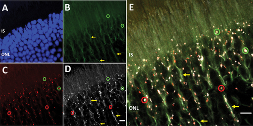 Figure 5. Cytosol and phagosome colocalization of RFP-GFP-LC3 reporter chimeric protein. (A) DAPI labeling of the outer nuclear layer (ONL) to elucidate tissue orientation (ONL). (B) Cytosolic EGFP signal was observed in the IS, as well as in the perinuclear region (yellow arrows). Few EGFP-positive punctate structures were observed, which most likely were immature phagosomes (representative green circles). (C) Photoreceptors exhibited RFP-positive autolysosomes in the myoid region of the IS, as well as in the perinuclear region (representative red circles). (D) Immunohistochemistry against the amino-terminus of the chimeric protein (i.e., RFP) suggests excessive cytosolic LC3 levels (yellow arrows), which colocalized with EGFP fluorescence. Also anti-RFP signal was specific to phagosome population (red and green circles) (E) Merge image shows RFP-EGFP-LC3 reporter chimeric protein in cytosolic state, as well as phagosome-bound state. Magnification: 40X objective; Zoom Factor, 5X. Scale bar: 5 µm.