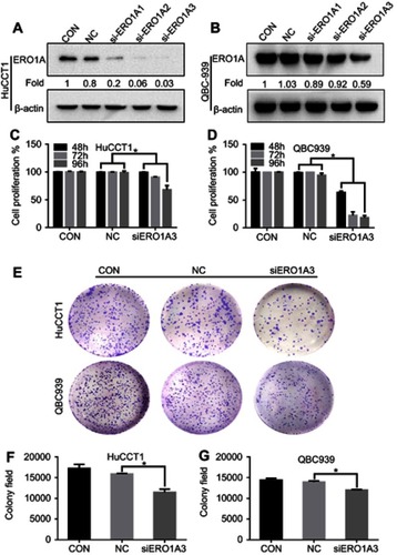 Figure 4 ERO1A depletion reduces CCA cell proliferation, colonization capacities. (A, B) Western blotting was used to detect expression of ERO1A after depletion. (C, D) The proliferation activity of ERO1A was determined by MTT assay in CCA cells. (E) Colony formation assays of HuCCT1 and QBC939 cells. (F, G) The statistical chart of colony formation assays. *P<0.05 vs NC.Abbreviations: CON, control; NC, negative control.