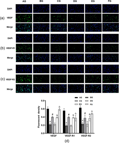 Figure 7 Expressions of VEGF, VEGF-R1 and VEGF-R2 protein in vitro verified by IF. (a-c) The positive expressions of VEGF, VEGF-R1 and VEGF-R2 after IF staining. The nucleus of PTCs was blue under the excitation of ultraviolet light, and the positive expression was green light labeled with corresponding fluorescein. (d) Quantification of fluorescent density of VEGF, VEGF-R1 and VEGF-R2 in different groups. Data are presented as the mean ± SD (n=3). *P<0.05 versus Control. #P<0.05 versus RSA. &P<0.05 versus miR-187 inhibitor NC. ΔP<0.05 versus miR-187 inhibitor.