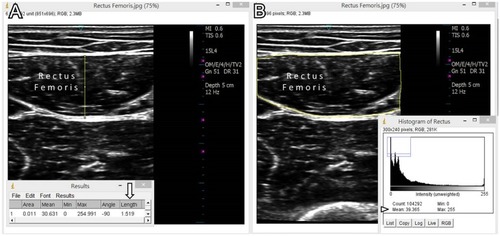 Figure 2 Measurement of the muscle thickness (arrow) (A) and mean echogenicity (arrowhead) (B) of the target muscles using the ImageJ software.