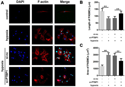 Figure 2 PTBP1 interference inhibits phenotypic switching of pulmonary artery smooth muscle cells. (A) F-actin staining was used to detect phenotypic changes in smooth muscle cells. (B) The cell length of PASMCs was calculated. (C) Results of the area of PASMCs were detected. n=6, **p<0.01.