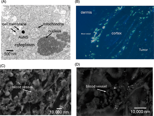 Figure 4. Microscopy of AuNS in PC-3 xenografts – TEM illustrates the size of the AuNS (140–150 nm) in relation to cellular organelles (a). Silver staining of the AuNS on polarized fluorescent microscopy (b) corroborated the observation that uptake near blood vessels which were most plentiful in the peripheral tumor cortex. SEM of individual vessels (c) further implied that the passively extravasated AuNS tended to cluster in the perivascular space (d).