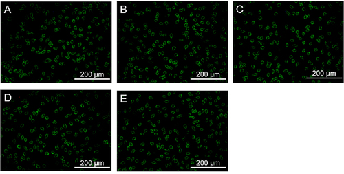 Figure 14 ROS fluorescence images of L929 co-culture with different concentrations of eluted group D fibers. (A) control group. (B) specimens eluted for 1 day. (C) specimens eluted for 3 days. (D) specimens eluted for 5 days. (E) specimens eluted for 7 days.