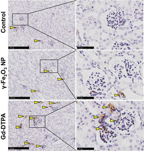 Figure 5 Histological images of kidney tissue staining with α-SMA. The right collum was the magnified area in the rectangle in the left collum. The scale bar is 250 μm in the left and 50 μm in the right. The arrow heads pointed the typical pathological changes in the tissue.