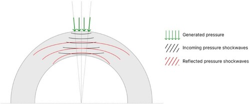 Figure 8. Schematic representation of shockwave propagation in the thin cross-section cylindrical component.
