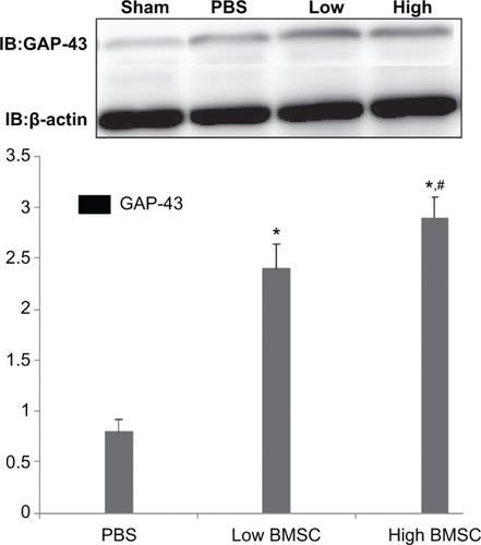 Figure 2 Western blot analysis of GAP-43 expression.