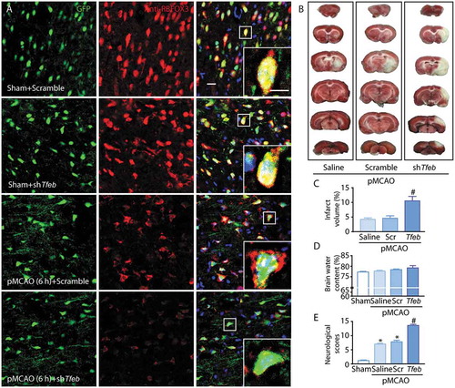 Figure 8. Neuronal-targeted TFEB knockdown aggravates the ischemic injury. (a) Representative images showing the abundance of neurons (red) in the cortex in sham-operated or pMCAO-treated rats injected with GFP-Scramble or shTfeb vectors; scale bar: 20 μm. High-magnification images of the boxed areas are shown in the inserts; scale bar: 10 μm. (b) Representative images of brain infarct volume in rats injected with GFP-Scramble or shTfeb vectors. (C–E) Quantification of infarct volume, brain water content and neurological scores in rats injected with GFP-Scramble or shTfeb vectors at 6 h after pMCAO. *p < 0.05 vs. sham + Scramble group; #p < 0.05 vs. pMCAO (6 h) + Scramble group.