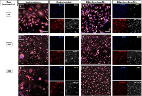 Figure 6. Immunofluorescence staining of ZIKV infected pre-OCs for NFATC1 and TM7SF4/DC-STAMP. Pre-OCS were infected with ZIKV (moi = 5) on day 3 post seeding. At the indicated time post cell culturing, ZIKV infected and mock infected cells were fixed, permeabilized and stained for ZIKV (green), NFACT1 (red), TM7SF4/ DC-STAMP (grey) and nuclei (DAPI, blue) for selected time points day 6 (A-B), day 10 (C-D) and day 14 (E-F) post seeding. The composite images are assembled based on the adjacent individual staining.