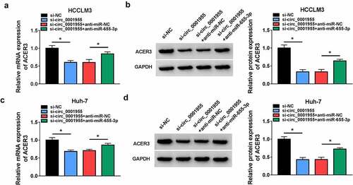 Figure 8. Circ_0001955 up-regulates ACER3 expression via inhibition of miR-655-3p. (a-d) qRT-PCR and Western blot analysis of ACER3 expression level in HCCLM3 and Huh-7 cells transfected with si-NC, si-circ_0001955, si-circ_0001955 + anti-miR-NC, or si-circ_0001955 + anti-miR-655-3p. *P < 0.05.