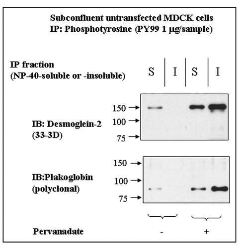 Figure 5 Dsg2 and Pg are slightly tyrosine-phosphorylated in the insoluble fraction of control cells. Untransfected MDCK cells were either untreated or treated with pervanadate for 15 minutes prior to detergent fractionation and subsequent immunoprecipitation using the monoclonal anti-phosphotyrosine antibody PY99. Samples were fractionated with equal loading by SDS-PAGE and immunoblotted for endogenous Dsg2 and Pg. As expected Dsg2 and Pg in the pervanadate-treated samples were tyrosine-phosphorylated. There was also tyrosine-phosphorylated Dsg2 and Pg in the soluble fraction of untreated cells yet apparently none in the insoluble fraction. As this population of protein was undetectable within the ectopic mDsg2HA IPs it must be assumed that it represents a small proportion of the cellular pool of these proteins.