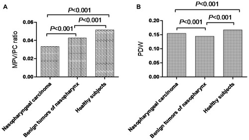Figure 1 (A) MPV/PC ratio in patients with NPC, those with benign tumors of the nasopharynx, and healthy subjects. (B) PDW in patients with NPC, those with benign tumors of the nasopharynx, and healthy subjects.Abbreviations: MPV/PC ratio, mean platelet volume/platelet count ratio; PDW, platelet distribution width; NPC, nasopharyngeal carcinoma.