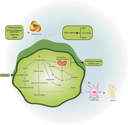 Figure 1 Pathogenesis of nonalcoholic fatty liver disease. The pathogenesis of NAFLD is complex and currently considered to be associated with insulin resistance, mitochondrial damage, oxidative stress and intestinal dysbiosis, etc.