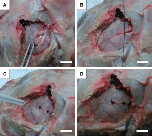 Figure 8 Dural repair in a goat brain model via the in situ electrospinning of NOCA fibers.Notes: Optical images show the procedure of in vivo simulation experiment. (A) A defect of 7 cm in length was produced. (B) The dura was primarily sutured to avert rupture. (C) The NOCA fibers were precisely electrospun onto the defect. (D) The dural defect was repaired by the NOCA membrane. Scale bar represents 20 mm.Abbreviation: NOCA, N-octyl-2-cyanoacrylate.