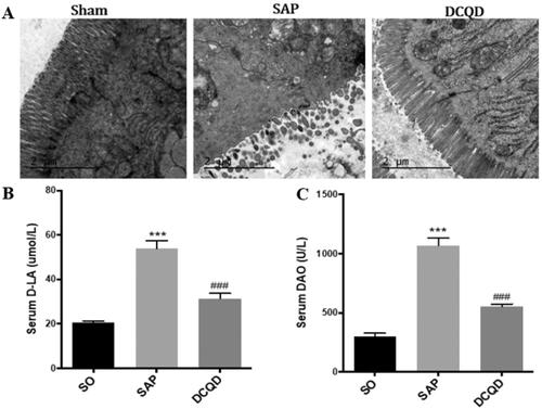 Figure 4. Impact of DCQD on SAP-associated intestinal injury. (A) Electron microscopic images of intestinal tissue of each experimental group (2 µm). (B) Serum d-LA levels of each experimental group. (C) Serum DAO levels of each experimental group. ***p < 0.001, compared with the SO group; ###p < 0.001, compared with the SAP group. n = 10–14.