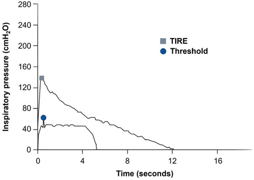 Figure 1 Comparison of the maximal inspiratory effort slopes obtained via the TIRE method and traditional inspiratory muscle assessment utilizing a threshold device.