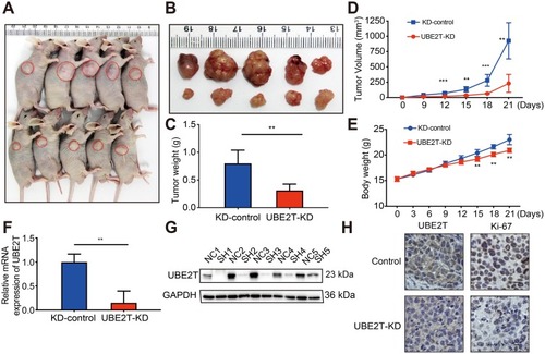 Figure 4 UBE2T regulates the tumorigenesis of HCC. (A) UBE2T-KD (SMCC-7721) cells xenograft tumors formed in nude mice (n=5 per group); (B) tumors were collected 21 days after xenotransplantation. (C) Comparison of tumor weight in control group and UBE2T-KD group; (D) UBE2T-KD (SMCC-7721) and control cell line KD-control growth curve of subcutaneous tumor volume in nude mice (measured once every 3 days, measuring maximum diameter a and minimum diameter b, respectively, calculating tumor volume according to formula V=a×b2/2); (E) subcutaneous inoculation in nude mice post-cell weight change curve (measured once every 3 days); (F) qPCR results for detection for mRNA level of UBE2T in xenograft tumors; (G) Western blots results for detection for UBE2T in xenograft tumors, N: KD-control, S: UBE2T-KD. (H) Immunohistochemical detection of UBE2T interference on tumor proliferation marker Ki-67 (200×). GAPDH was used as internal control. The statistical data are expressed as mean±SEM, compared with the control group, **P<0.01, ***P<0.001.Abbreviations: HCC, hepatocellular carcinoma; UBE2T, ubiquitin-conjugating enzyme E2T; GAPDH, glyceraldehyde 3-phosphate dehydrogenase; UBE2T-KD, UBE2T knockdown; KD-control, control cells transfected with the control vector.