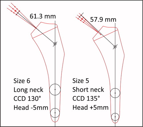 Figure 3. Examples of measurements of total neck length. The figure shows all possible measuring points along the 3 different CCD angles. The point of intersection is defined as the intersection between the CCD 130° line and the longitudinal axis of the stem.