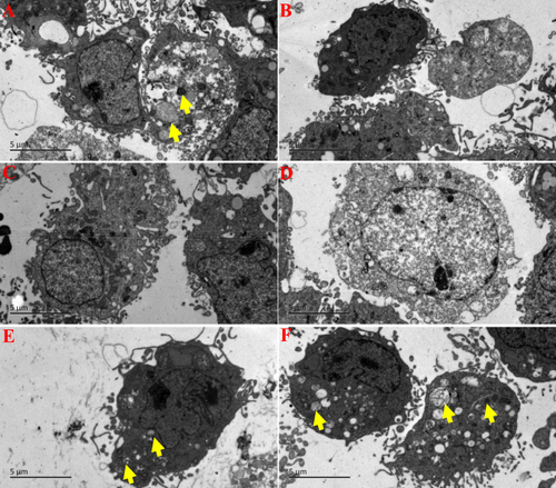 Figure 11 The effect of ZgI-AuNPs on the autophagy of mice HSCs cells. (A).NC group: saline. (B). CTX group:CTX + saline. (C). CLQ group: CLQ + saline. (D). CTX+CLQ group: CTX + CLQ + saline. (E). ZgI group: ZgI + CTX + CLQ + saline. (F).ZgI-AuNPs group: ZgI-AuNPs + CTX + CLQ + saline. The yellow arrows represents the autophagosomes.