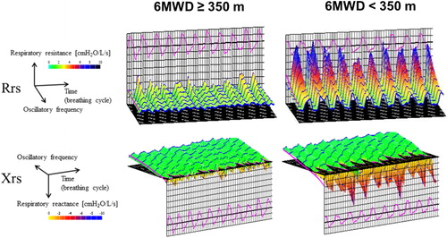 Figure 2. Colored 3 D images of Rrs and Xrs in each from an individual subject in each category. These images show the 30-second time course of Rrs and Xrs during tidal breathing. Oscillometric values, including R5 and X5, were output automatically by the computer.Abbreviations: Rrs, respiratory system resistance; R5, Rrs at 5Hz; Xrs, respiratory system reactance; X5, Xrs at 5Hz; 6MWD, 6-minute walking distance.