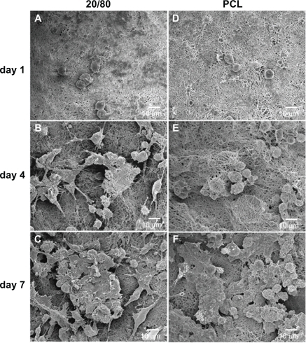 Figure 7 Scanning electron microscopy images of mRPCs grown on CS-PCL/PCL (20/80) (A–C) and PCL (D–F) nanofibrous scaffolds on day 1 (A, D), 4 (B, E), and 7 (C, F) after incubation.Abbreviations: CS-PCL, cationic chitosan-graft-poly (ɛ-caprolactone); mRPC, mouse retinal progenitor cell; PCL, polycaprolactone.