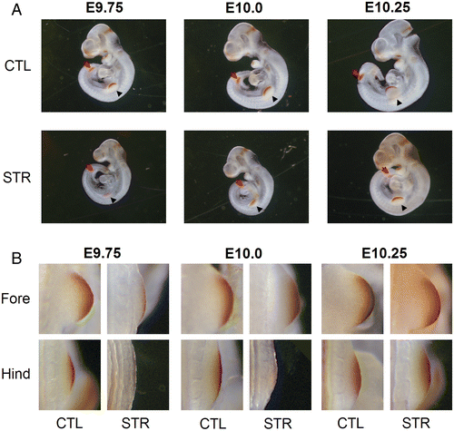 Figure 4.  The growth of limb bud in control and maternally stressed embryo. (A) and (B). E9.75, 10.0, and 10.25 fetuses were fixed and immunostained with anti-Fgf8 antibody as described in the Materials and Methods. Fgf8-immunoreactivity was visualized as brown color by the DAB method. The arrowhead indicates developing forelimb and the red arrow indicates the developing hindlimb. These results were reproduced in three independent litters.