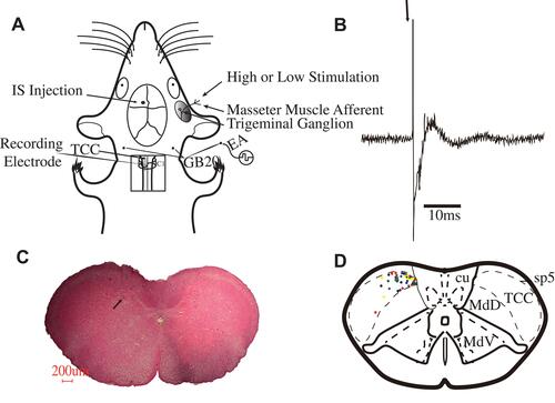 Figure 3 (A) Pattern diagram of EA intervention, dural IS injection, electrophysiological recording in the TCC area and high and low-intensity stimuli. (B) An original tracing from a typical unit responding to stimulation of a receptive field (latencies in the Aδ-fiber range). Black arrow represents stimulus artefact. (C) A pathological diagram of an electrophysiological recording area in TCC section. The arrow refers to the electrical area of damage, corresponding to the recording electrode’s pinpoint location. (D) The collection diagram of TCC electrophysiological recording sites. Black dots represent control group, red dots represent model group, green dots represent EA group, blue dots represent NA group, yellow dots represent SEA group, and gray dots represent SNA group.