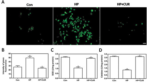 Figure 2. Effect of curcumin (20 μM) on the increased oxidative stress in INS-1 cells treated with HP. ROS levels were determined using DCFH-DA. (A) Representative images of cells stained with DCFH-DA. Scale bar: 20 μm. (B) Fluorescence intensity of DCFH-DA (*p < .05 vs Con group, #p < .05 vs HP group). (C) SOD levels in cells. (D) catalase activity in cells. n = 5 independent experiments. CUR, curcumin; ROS, reactive oxygen species; CUR, curcumin; HP, 30 mM glucose+0.5 mM palmitate; DCFH-DA, 2’,7’-dichlorodihydro fluorescein diacetate; Con, control; SOD, super oxide dismutase.