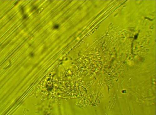 Figure 8 Clumping of lactobacilli: matrix formation with biofilm appearance.
