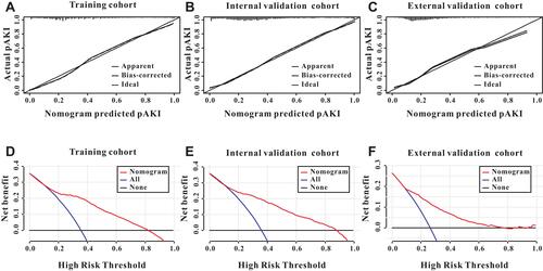 Figure 5 Calibration and clinical utility of the predictive nomogram. The predictive nomogram exhibited a high correlation between the actual probability and predicted probability in the training cohort (A), internal validation cohort (B) and external validation cohort (C). Decision curves analysis for the predictive nomogram to predict the persistent acute kidney injury in the training cohort (D), internal validation cohort (E) and external validation cohort (F).
