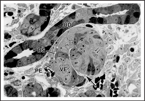 Figure 1 Light micrograph of section of developing rat kidney showing comma-shaped nephric figure. A vascular cleft (large arrow) has formed and is the site of angioblast ingress. Visceral epithelial cells (VE) will develop into podocyes, and parietal epithelial cells (PE) will line Bowman's capsule. A small Bowman's space (BS) can be observed. Note mitotic figures (double arrows) in developing tubular segment of the forming nephron. UD: Ureteric duct. Reproduced with permission (ref. Citation36).